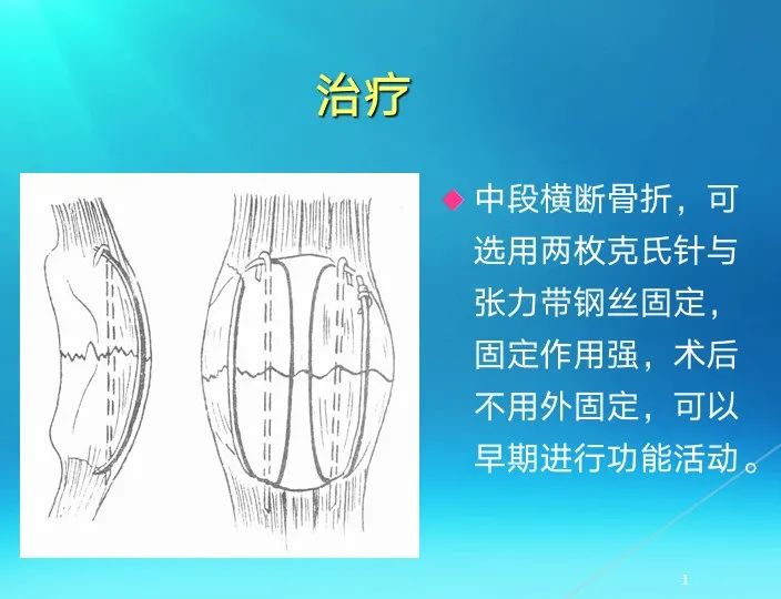 下肢骨关节损伤诊治全过程，图文解析更易懂！