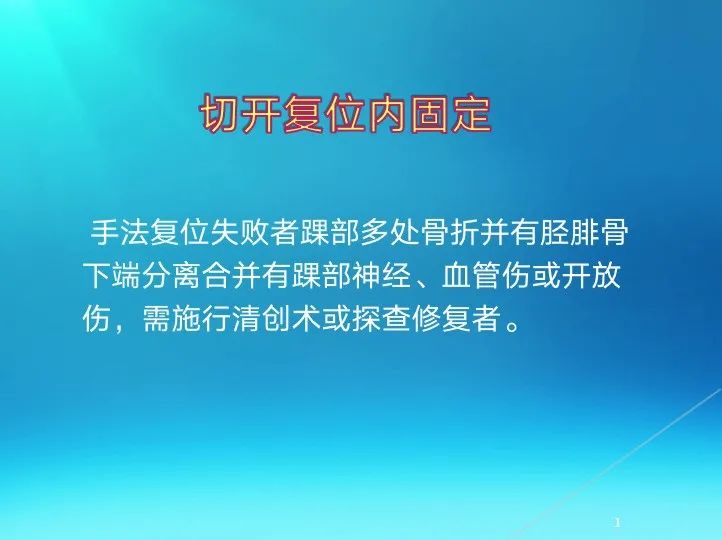 下肢骨关节损伤诊治全过程，图文解析更易懂！