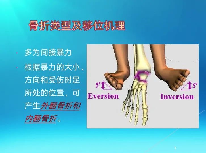 下肢骨关节损伤诊治全过程，图文解析更易懂！