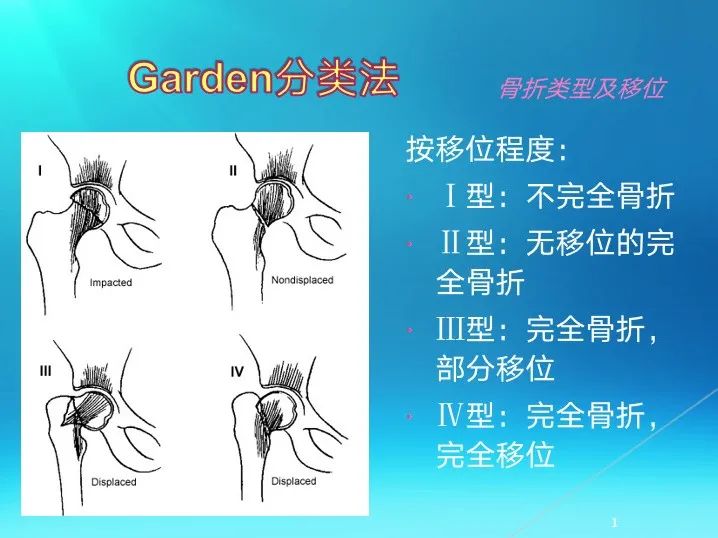 下肢骨关节损伤诊治全过程，图文解析更易懂！