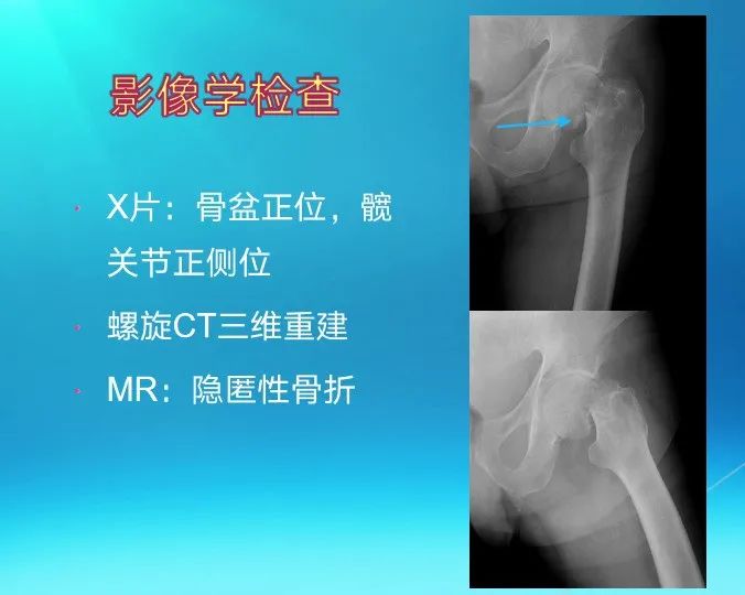 下肢骨关节损伤诊治全过程，图文解析更易懂！