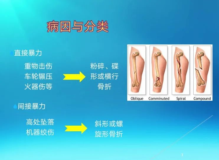 下肢骨关节损伤诊治全过程，图文解析更易懂！