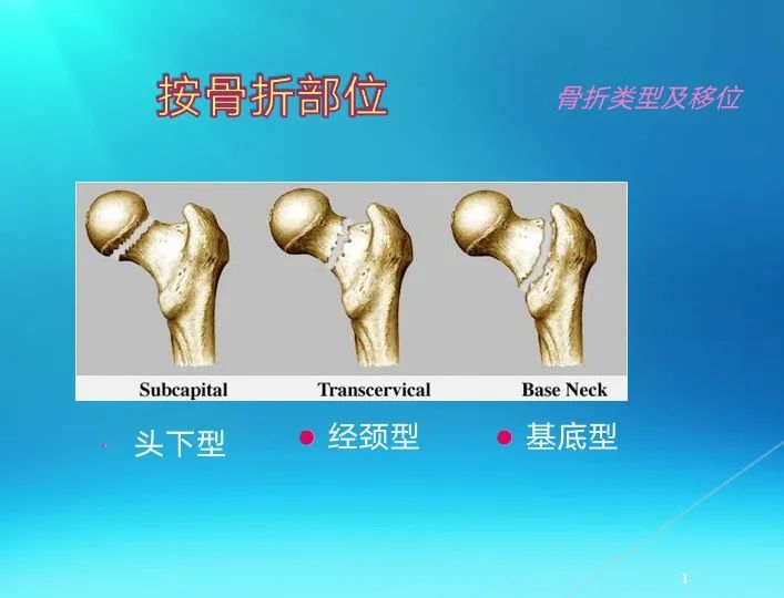 下肢骨关节损伤诊治全过程，图文解析更易懂！