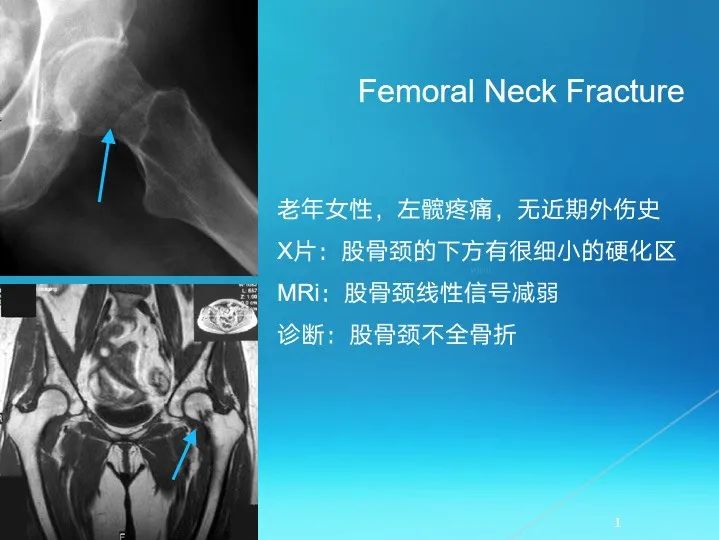 下肢骨关节损伤诊治全过程，图文解析更易懂！