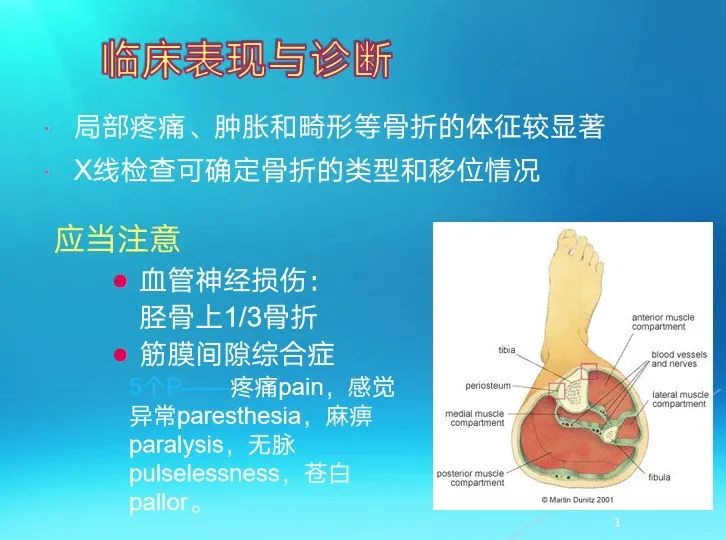 下肢骨关节损伤诊治全过程，图文解析更易懂！