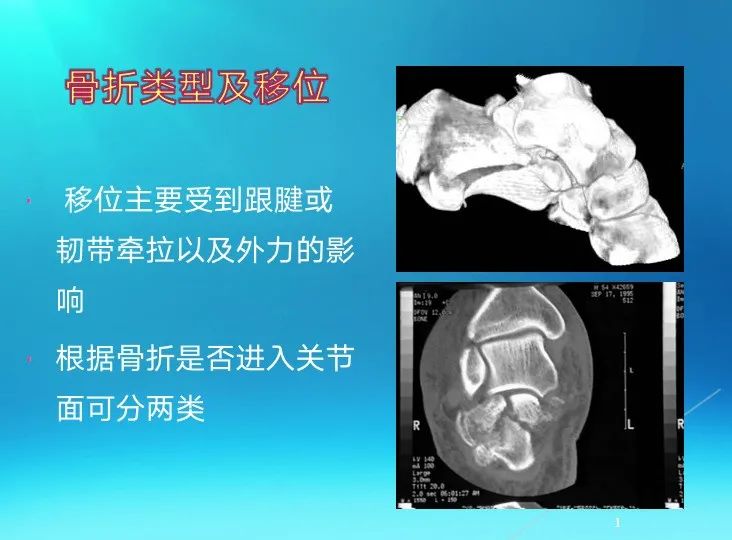 下肢骨关节损伤诊治全过程，图文解析更易懂！