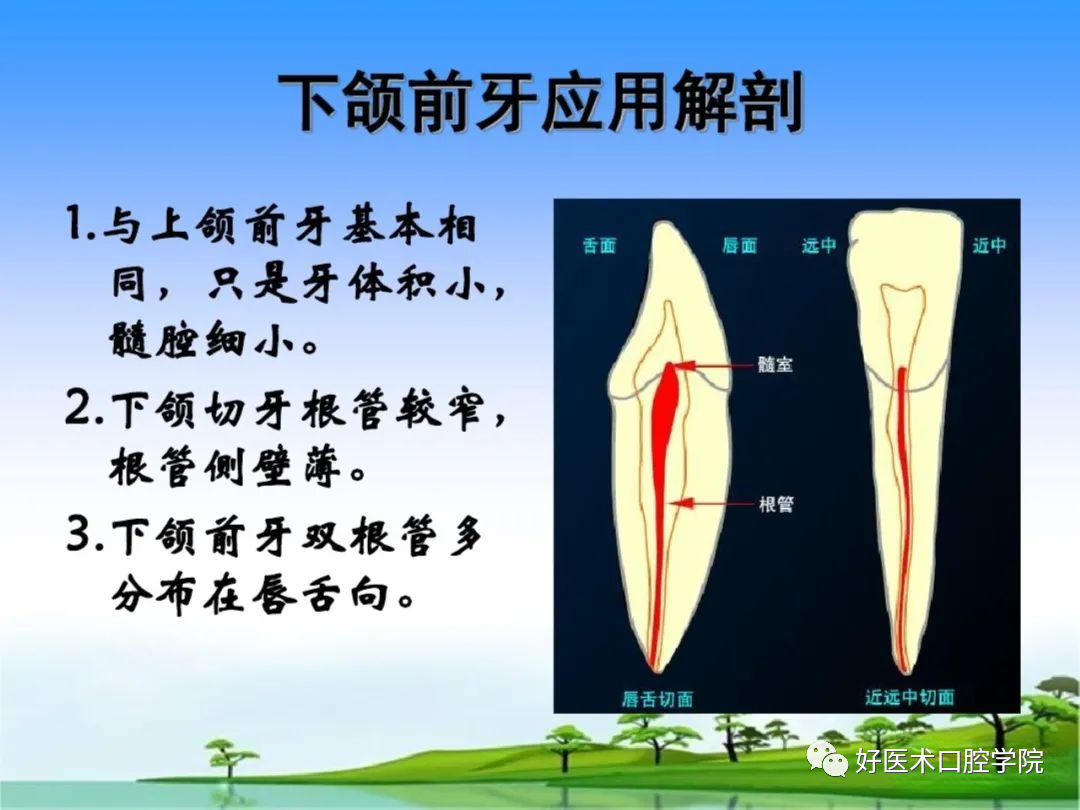 综合总结开髓技术与操作要点，看这一篇就够了！