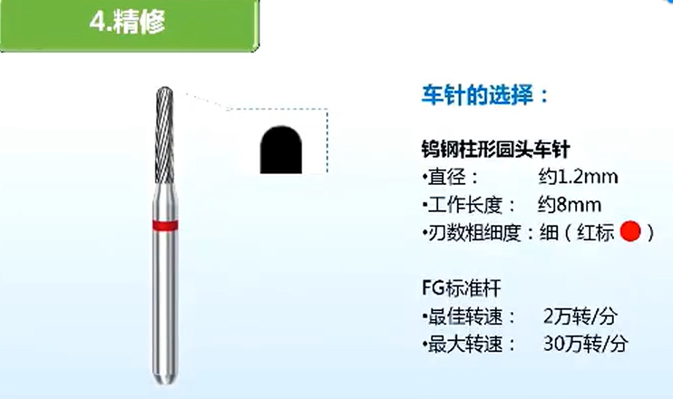 图文结合一步步教会你瓷贴面牙体预备方法，值得收藏！