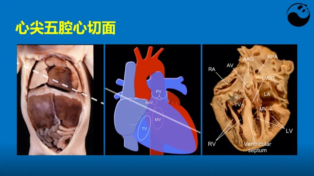 学好超声心动图，这些心脏解剖知识要掌握！