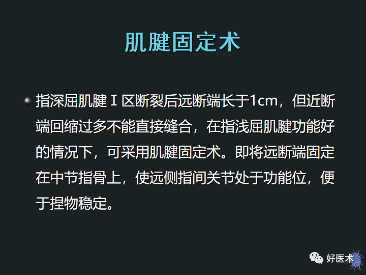 骨科必备技能肌腱缝合固定术，图文详解清晰明了！