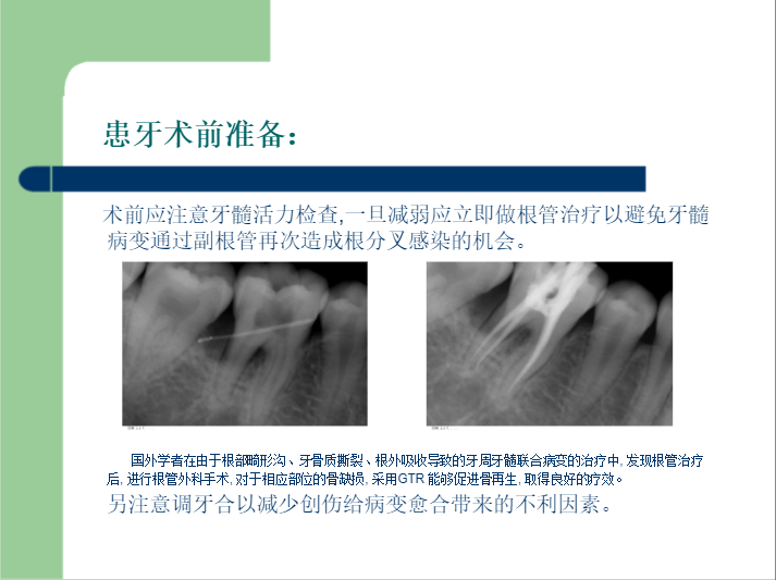 学习引导组织再生术，拯救越来越严重的牙周炎！