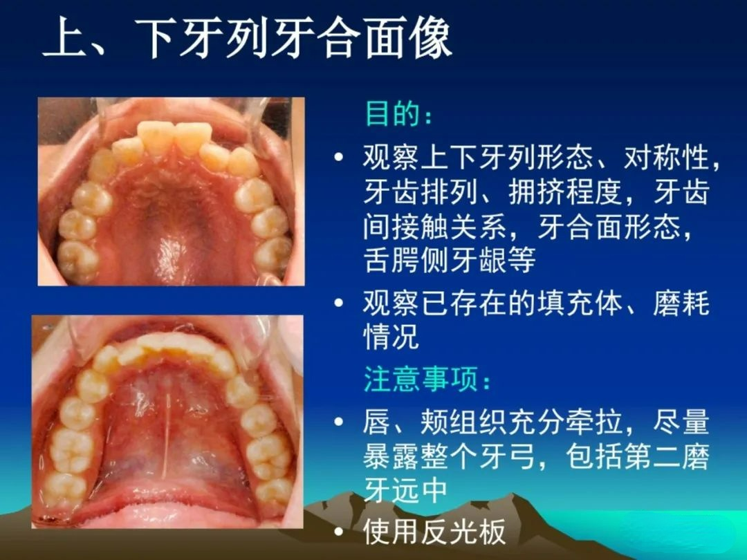 一文教你成为口腔摄影高手，拍出高格口腔图片！