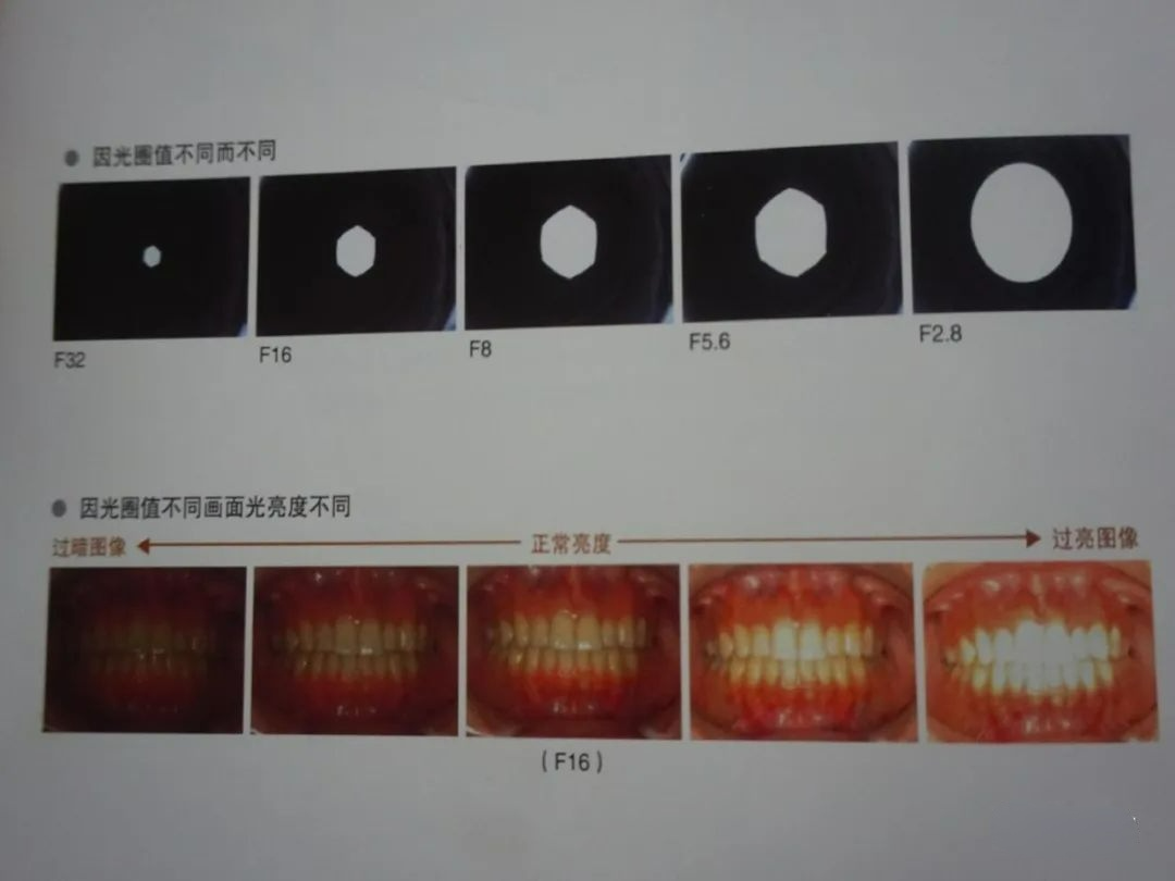 一文教你成为口腔摄影高手，拍出高格口腔图片！