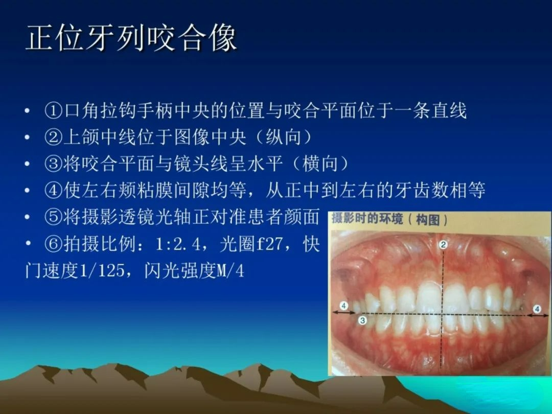 一文教你成为口腔摄影高手，拍出高格口腔图片！