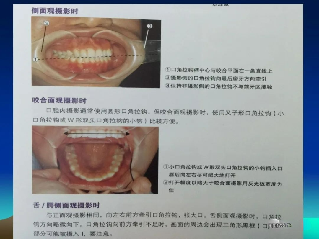 一文教你成为口腔摄影高手，拍出高格口腔图片！