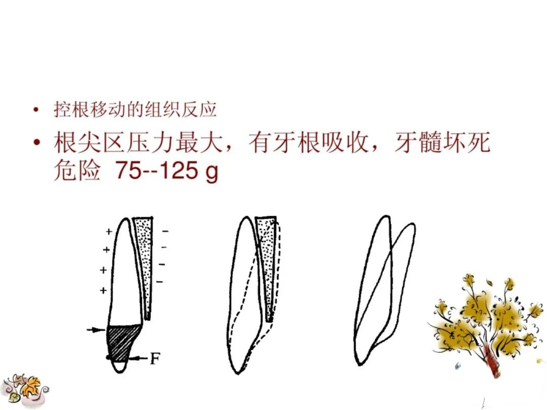 正畸矫治的生物力学总结，正畸基础必看！