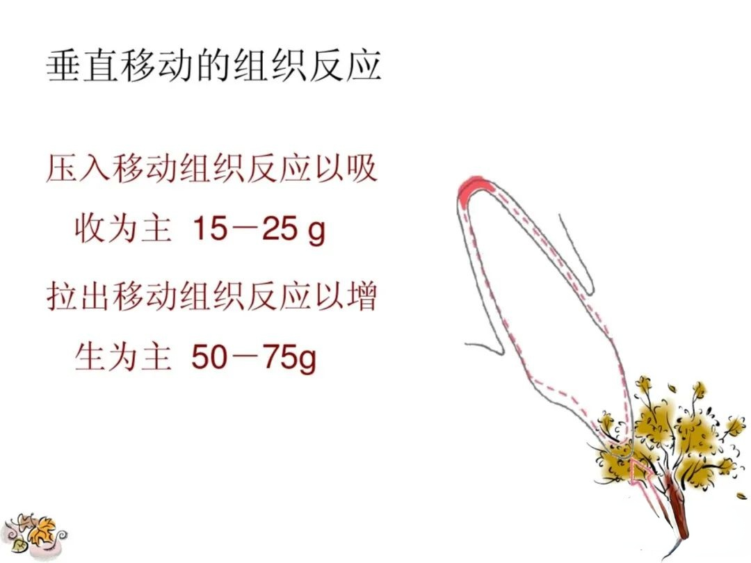 正畸矫治的生物力学总结，正畸基础必看！