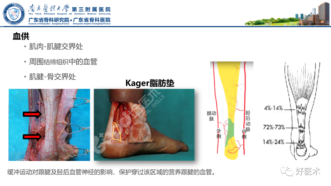 跟腱断裂的修复与重建手术全流程，这篇课件讲解打满分！