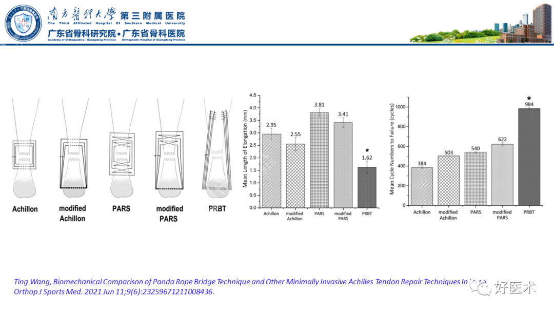 跟腱断裂的修复与重建手术全流程，这篇课件讲解打满分！