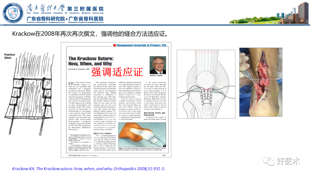 跟腱断裂的修复与重建手术全流程，这篇课件讲解打满分！