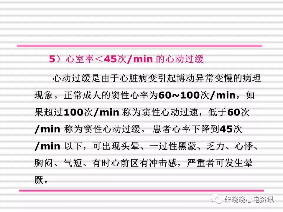 心电图危急值识别与诊断，这篇一定要收藏！