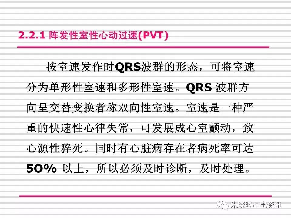 心电图危急值识别与诊断，这篇一定要收藏！