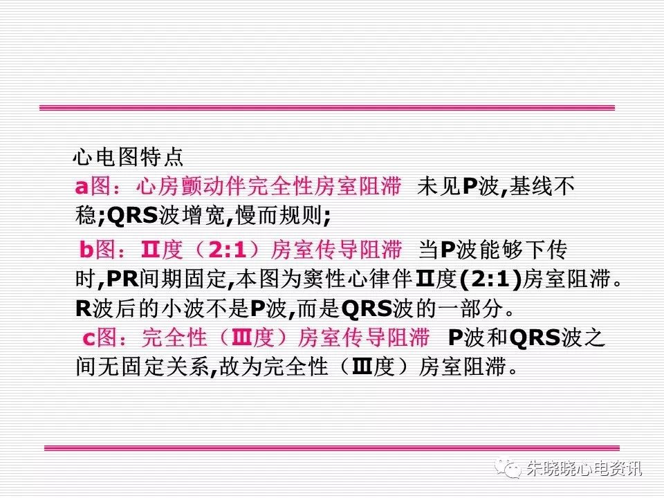 心电图危急值识别与诊断，这篇一定要收藏！