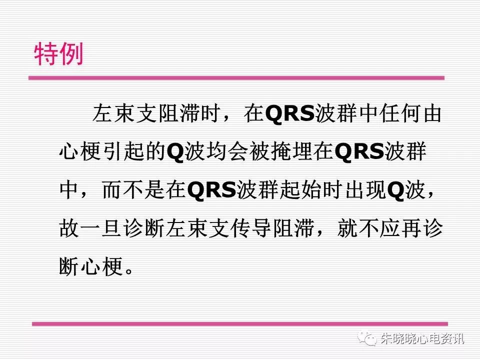 心电图危急值识别与诊断，这篇一定要收藏！