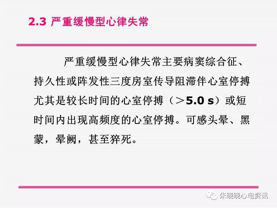 心电图危急值识别与诊断，这篇一定要收藏！