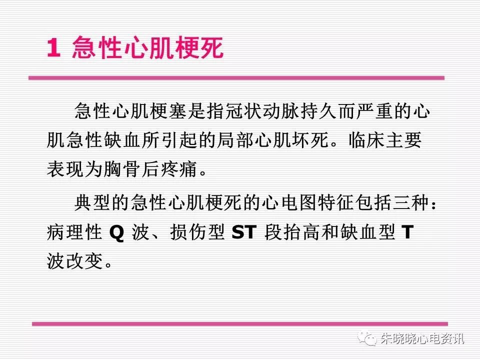 心电图危急值识别与诊断，这篇一定要收藏！