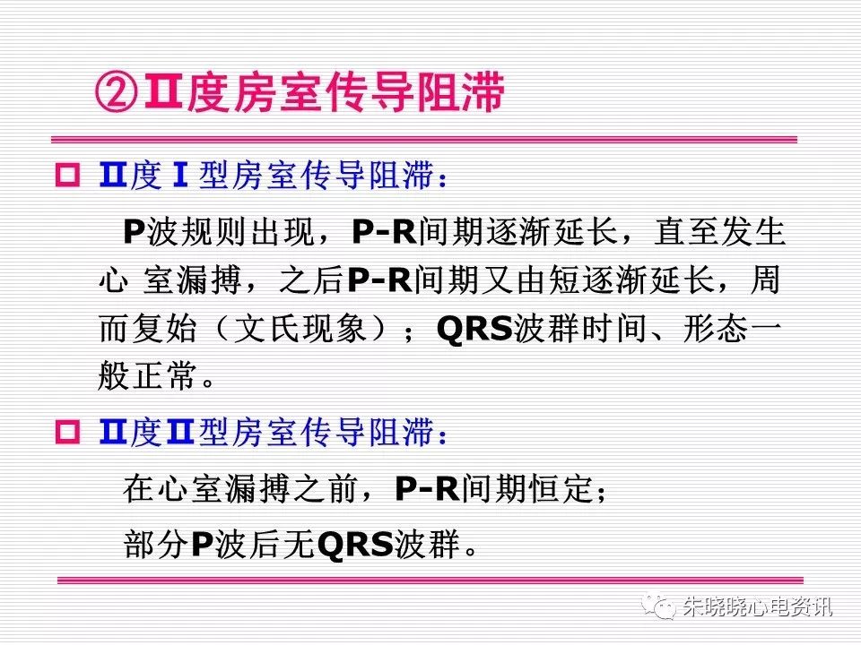 心电图危急值识别与诊断，这篇一定要收藏！