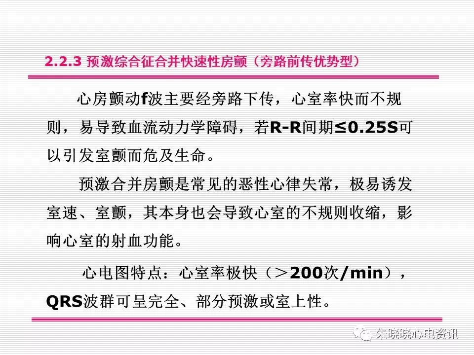 心电图危急值识别与诊断，这篇一定要收藏！