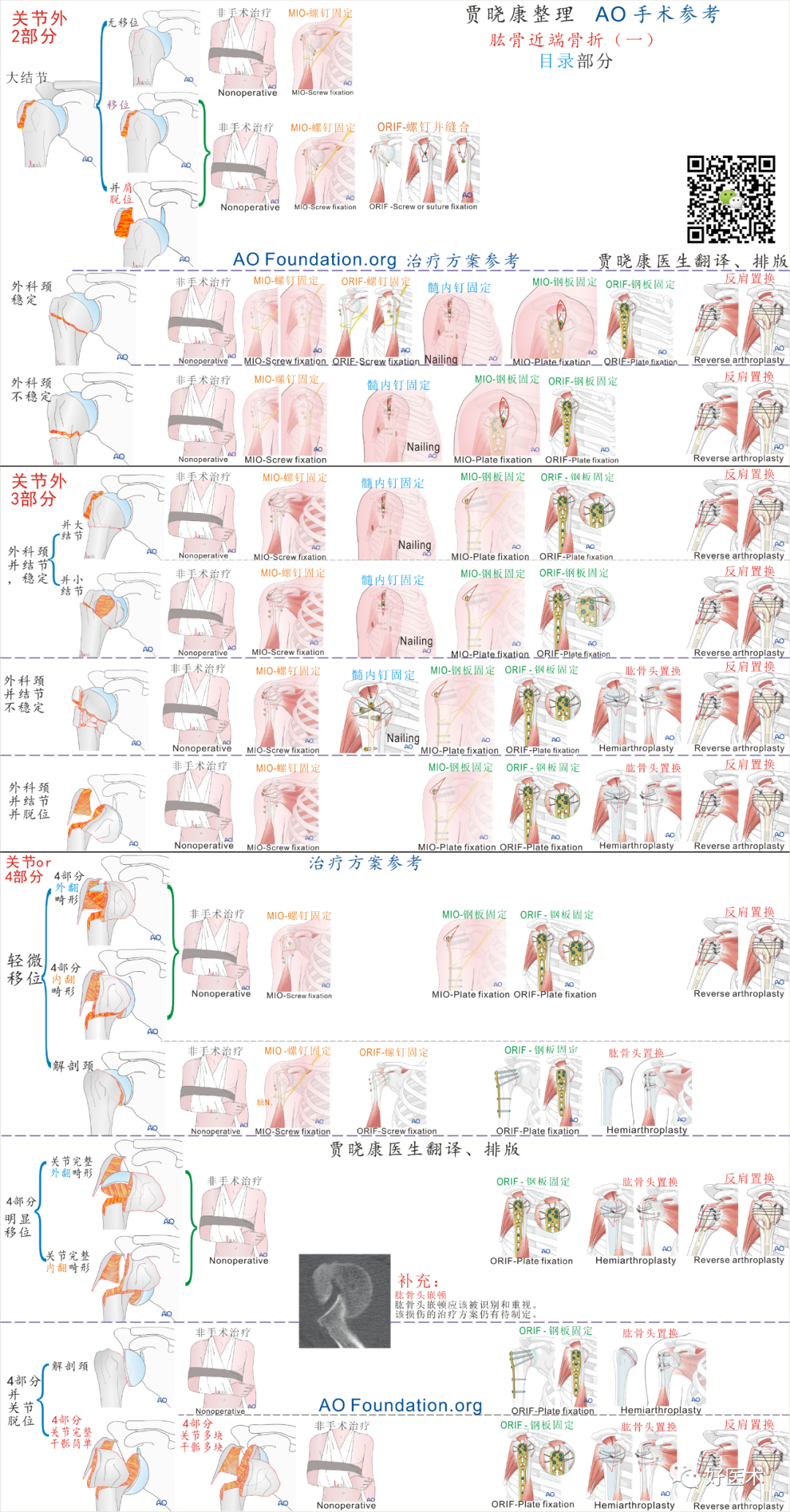 手术必备：15张超清知识卡片，全方位掌握肱骨近端骨折！