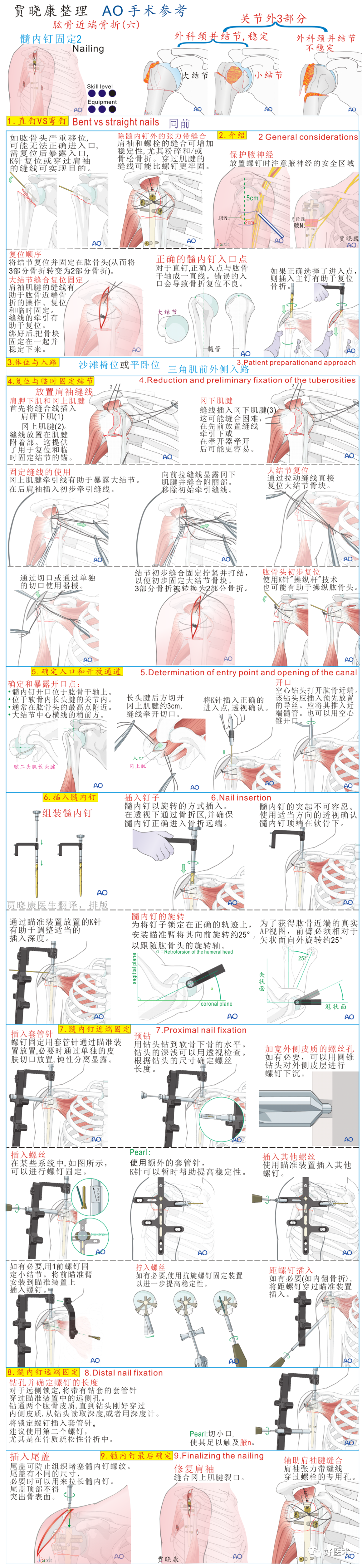 手术必备：15张超清知识卡片，全方位掌握肱骨近端骨折！