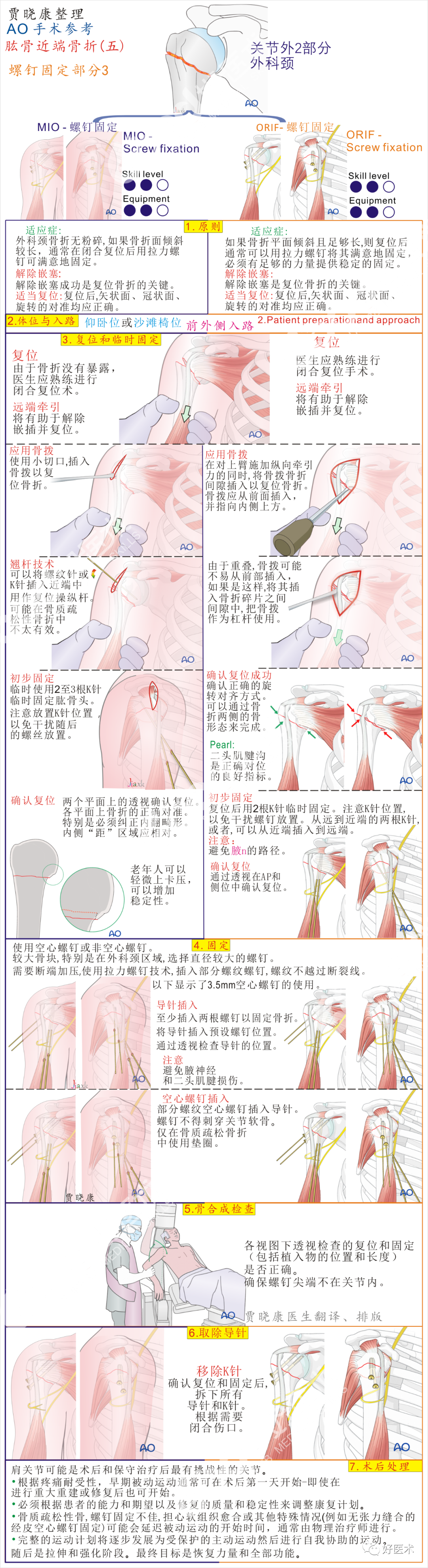 手术必备：15张超清知识卡片，全方位掌握肱骨近端骨折！