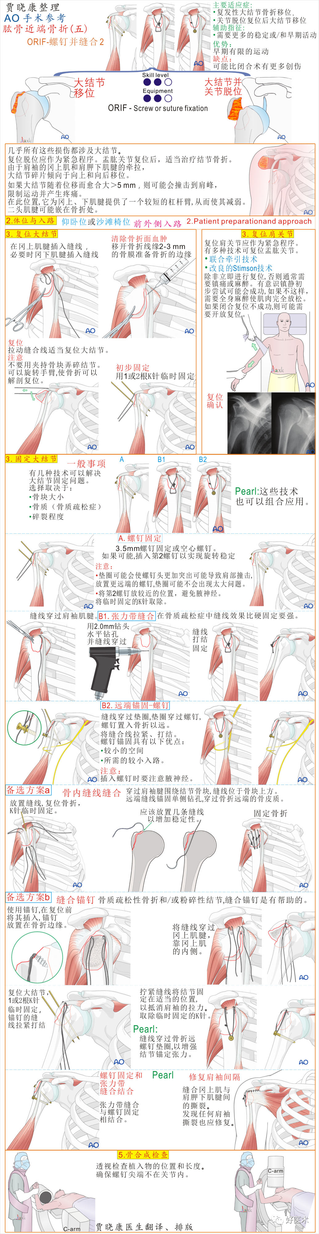 手术必备：15张超清知识卡片，全方位掌握肱骨近端骨折！