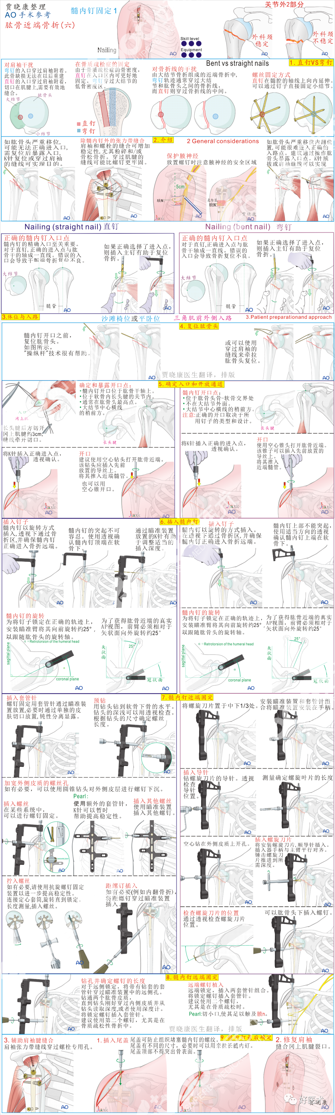 手术必备：15张超清知识卡片，全方位掌握肱骨近端骨折！