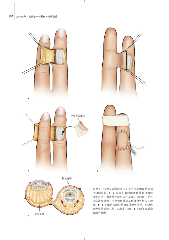 新书首发《手与上肢重建手术决策与技术》实用参考书！