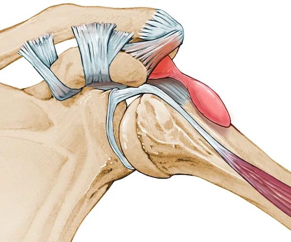 骨科医生：肩部疼痛难忍，练习7个动作很有用！