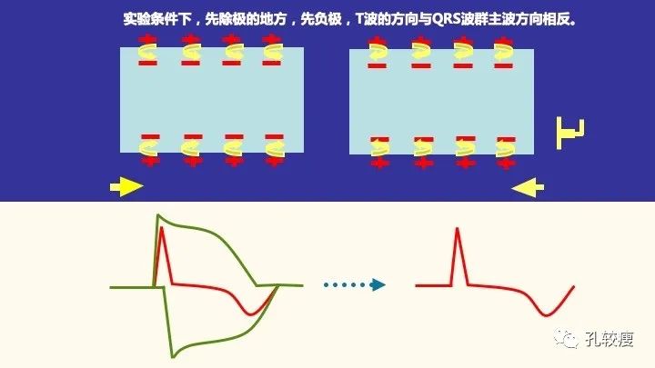 早读丨心电图太难懂学不会？这些基础知识一定要收藏！