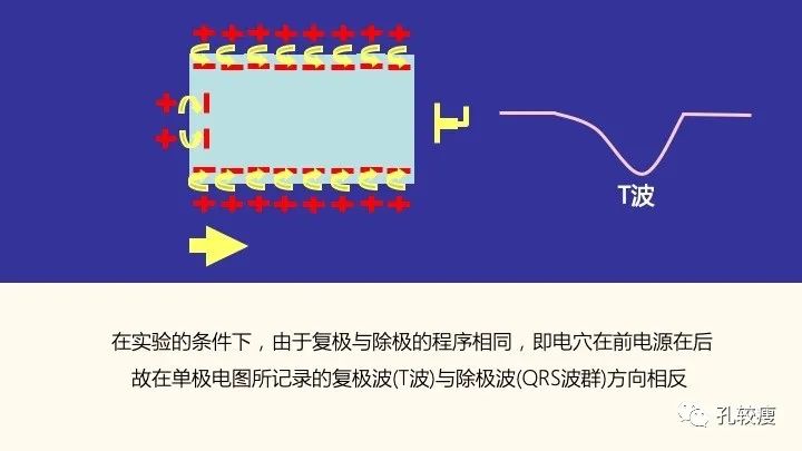 早读丨心电图太难懂学不会？这些基础知识一定要收藏！