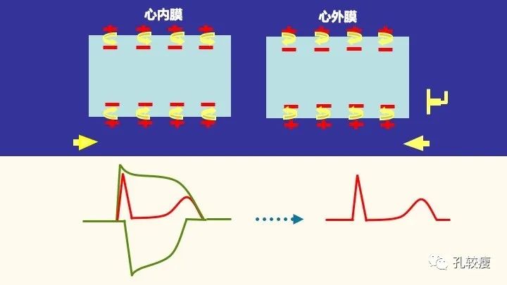 早读丨心电图太难懂学不会？这些基础知识一定要收藏！