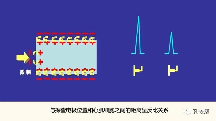 早读丨心电图太难懂学不会？这些基础知识一定要收藏！