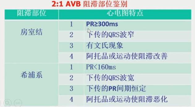 从浅入深，心脏阻滞部位确定超详解