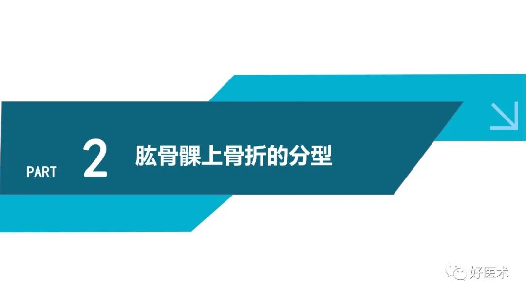 儿童肱骨髁上骨折的诊断与治疗