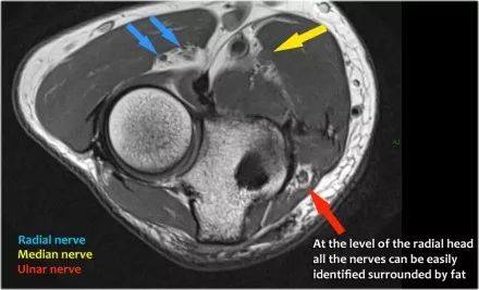 肘关节常见病的MRI图谱详解
