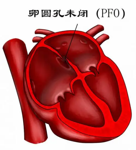 一文带你了解什么是“缺心眼”