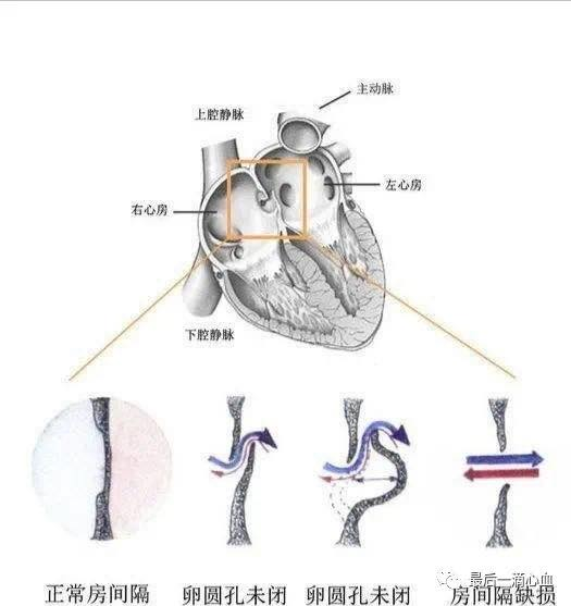 一文带你了解什么是“缺心眼”