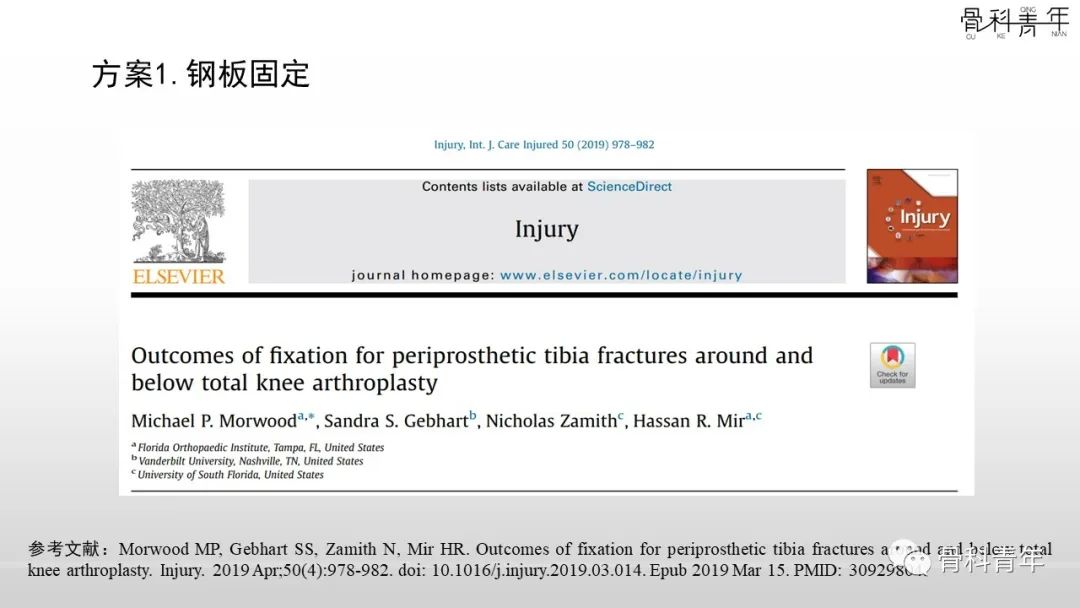 病例分享：胫腓骨多次骨折ORIF术后再骨折