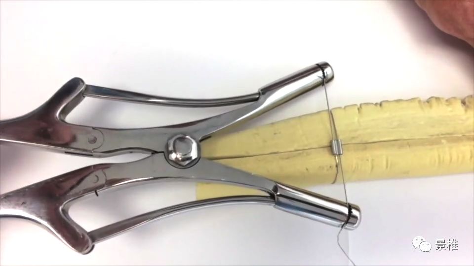 骨科手术技巧：钢丝捆扎大法